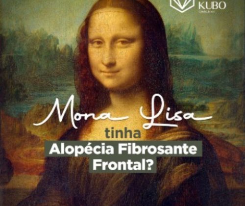 alopesia fribosante