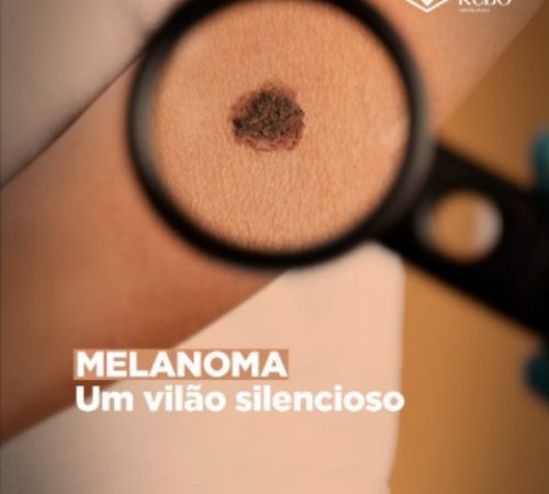 melanoma