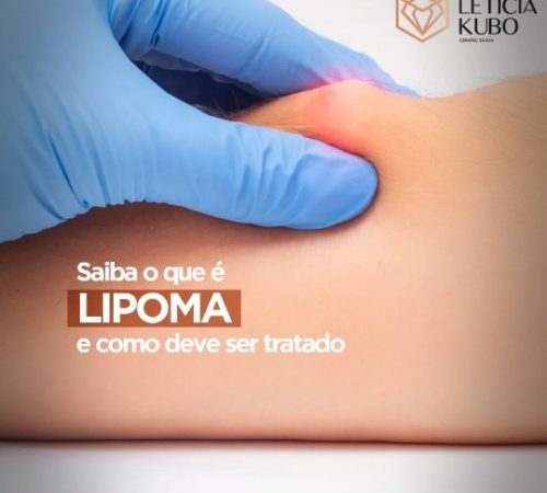 saiba o que lipoma